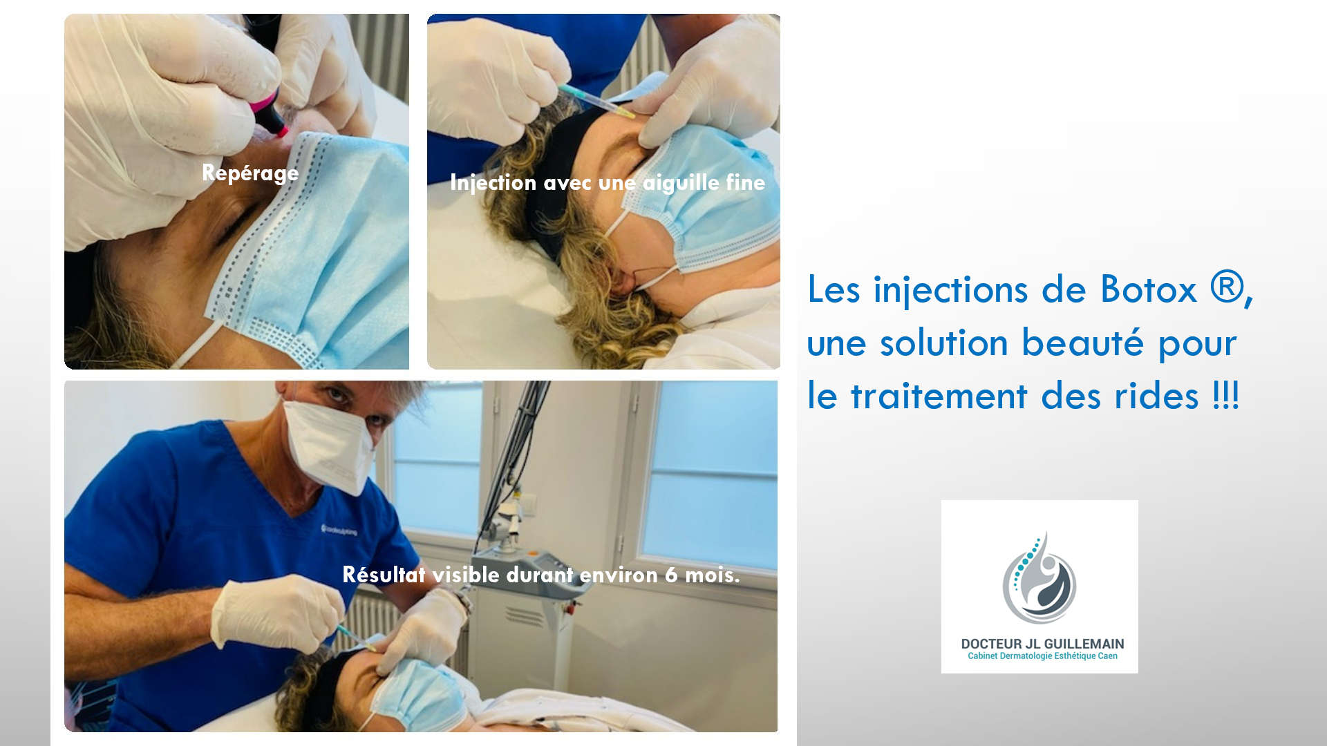 Botox Dr Jean-Louis Guillemain Caen